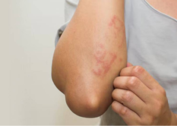 25 Common Allergies That Cause Itchy Skin