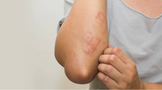 25 Common Allergies That Cause Itchy Skin