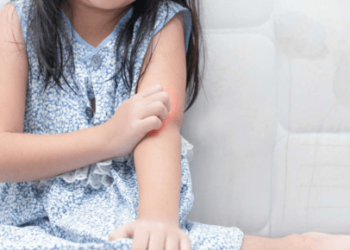 25 Common Causes of Skin Allergy and Itching
