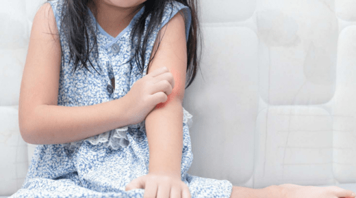 25 Common Causes of Skin Allergy and Itching