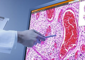 Robbins and Cotran Pathologic Basis of Disease PDF