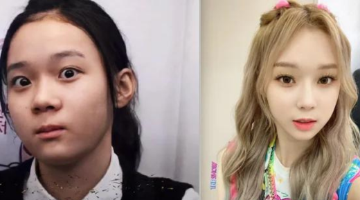 Unveiling the Transformative Journey - Korean Before and After Plastic Surgery