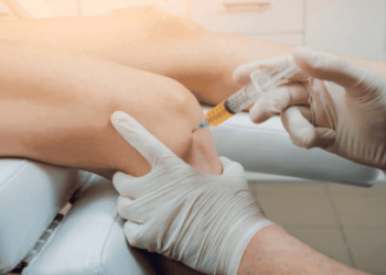 prp therapy