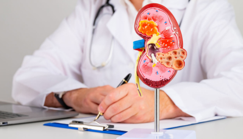 Nephrologist in Bangalore